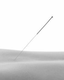 Clinical Acupuncture
